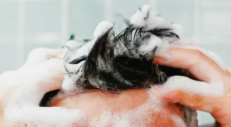 Fight Flakes - Dandruff Treatment Options